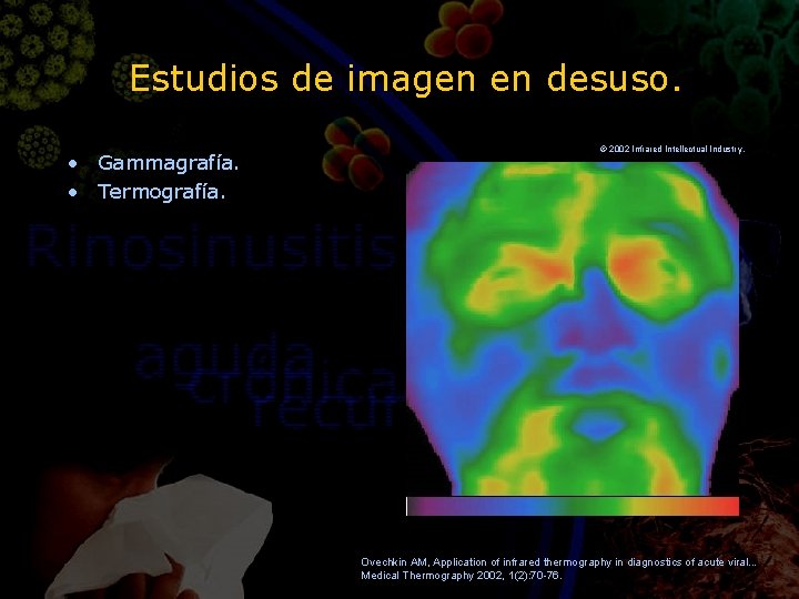 Estudios de imagen en desuso. • Gammagrafía. • Termografía. © 2002 Infrared Intellectual Industr