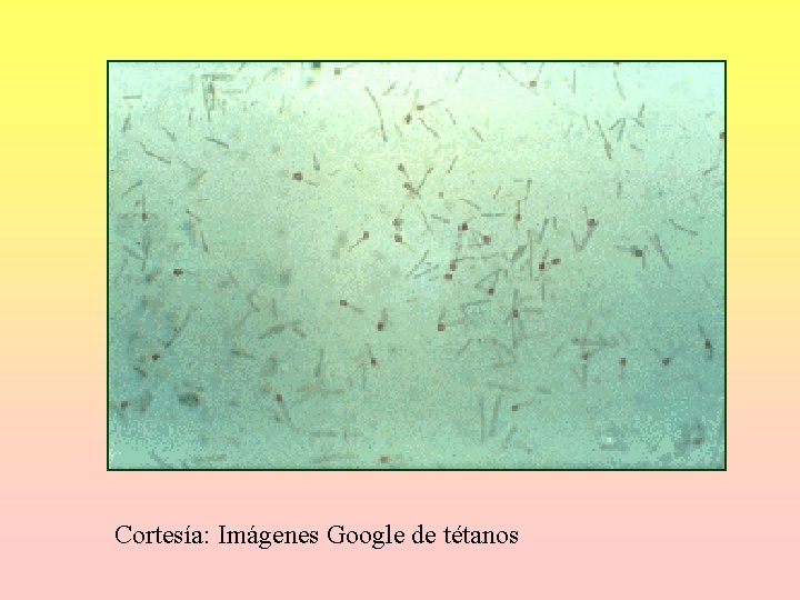 Cortesía: Imágenes Google de tétanos Cortesía: Imágenes Google de tétanos