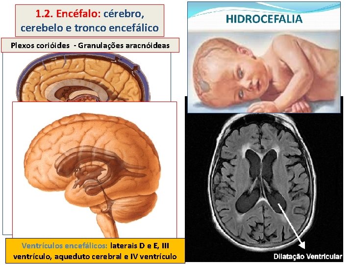 1. 2. Encéfalo: cérebro, cerebelo e tronco encefálico Plexos corióides - Granulações aracnóideas Ventrículos