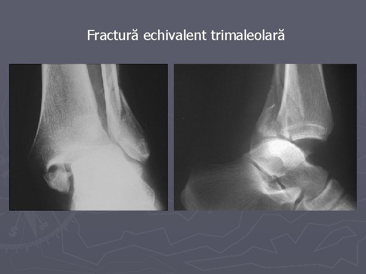 calmează rapid durerea în articulațiile picioarelor cauzele edemului articulației gleznei stângi