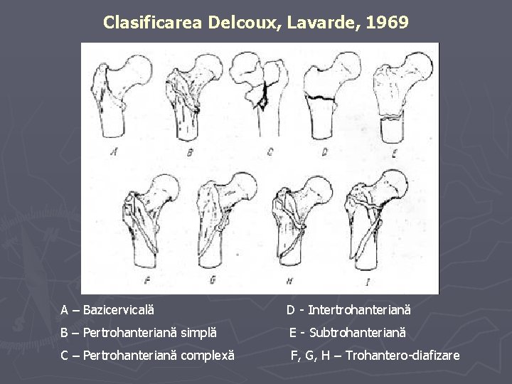 Clasificarea Delcoux, Lavarde, 1969 A – Bazicervicală D - Intertrohanteriană B – Pertrohanteriană simplă Clasificarea Delcoux, Lavarde, 1969 A – Bazicervicală D - Intertrohanteriană B – Pertrohanteriană simplă