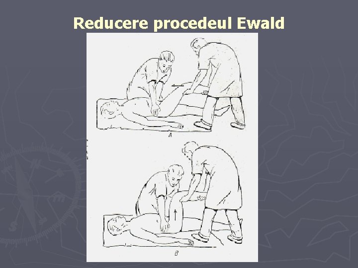 Reducere procedeul Ewald Reducere procedeul Ewald