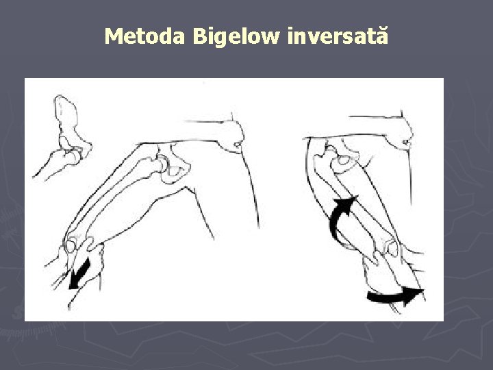 Metoda Bigelow inversată Metoda Bigelow inversată