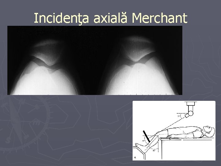 Incidenţa axială Merchant Incidenţa axială Merchant