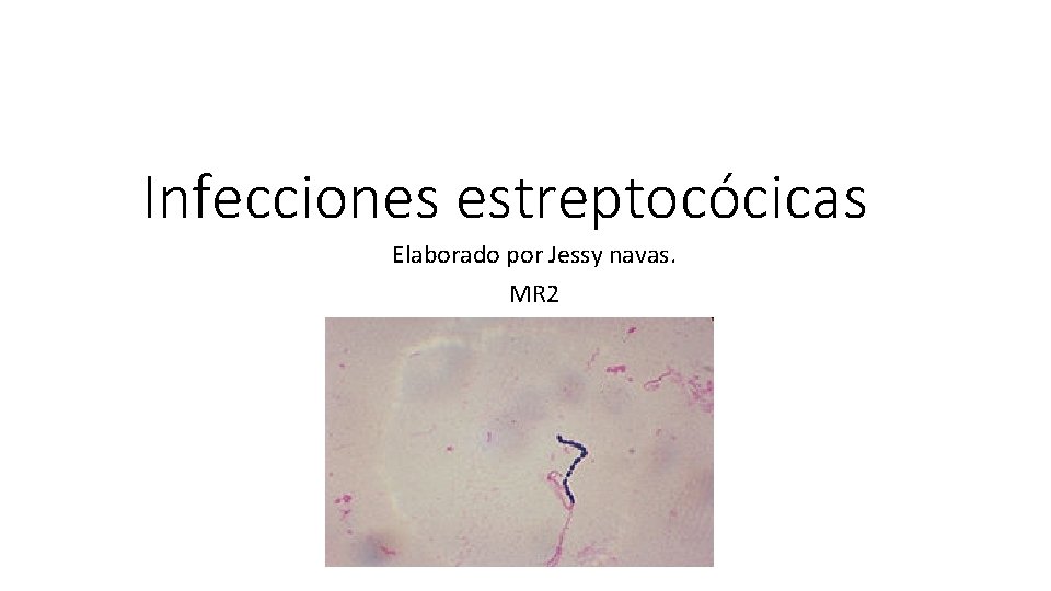 Infecciones estreptocócicas Elaborado por Jessy navas. MR 2 