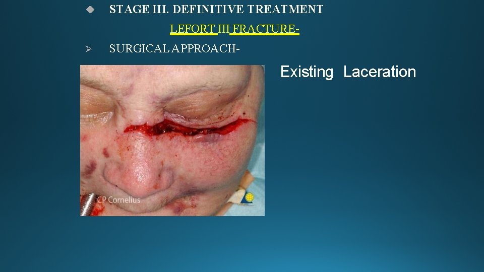  STAGE III. DEFINITIVE TREATMENT LEFORT III FRACTURE- SURGICAL APPROACH- Existing Laceration 