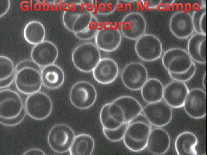 Glóbulos rojos en M. campo oscuro Glóbulos rojos en M. campo oscuro