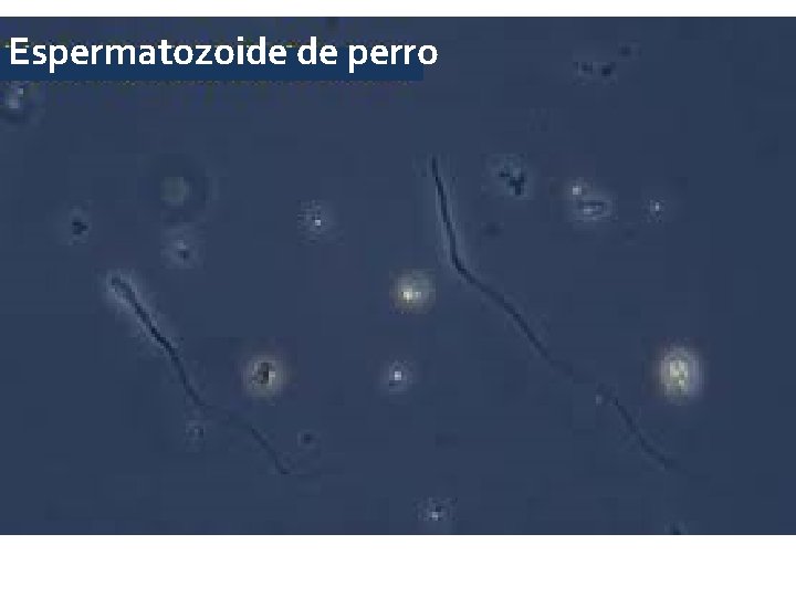 Espermatozoide de perro Espermatozoide de perro