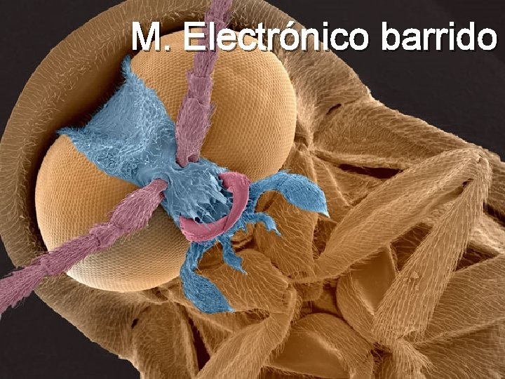 M. Electrónico barrido M. Electrónico barrido