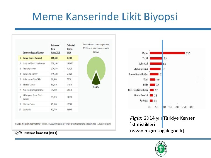 Meme Kanserinde Likit Biyopsi Figür. Meme kanseri (NCI) Figür. 2014 yılı Türkiye Kanser İstatistikleri