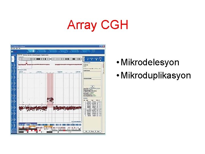 Array CGH • Mikrodelesyon • Mikroduplikasyon 