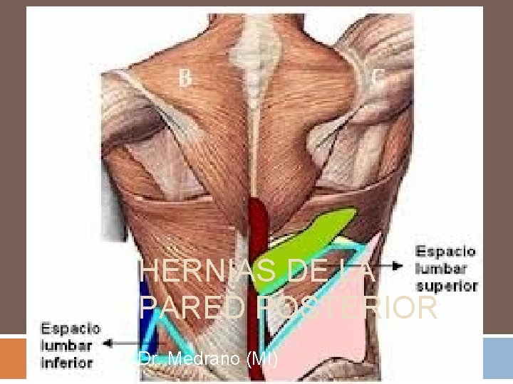 HERNIAS DE LA PARED POSTERIOR Dr. Medrano (MI) 