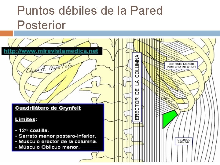 Puntos débiles de la Pared Posterior 