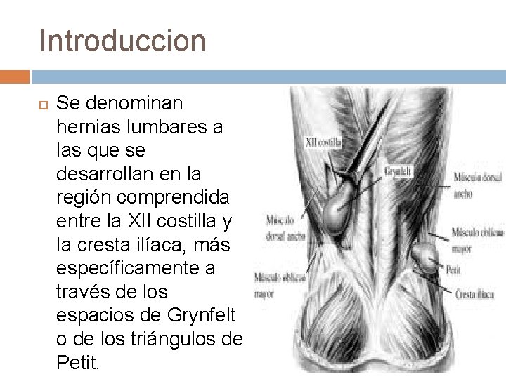 Introduccion Se denominan hernias lumbares a las que se desarrollan en la región comprendida