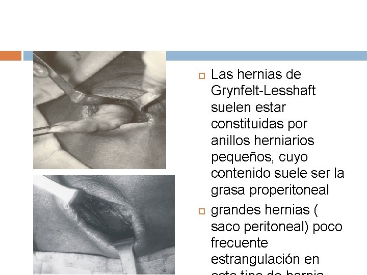  Las hernias de Grynfelt-Lesshaft suelen estar constituidas por anillos herniarios pequeños, cuyo contenido