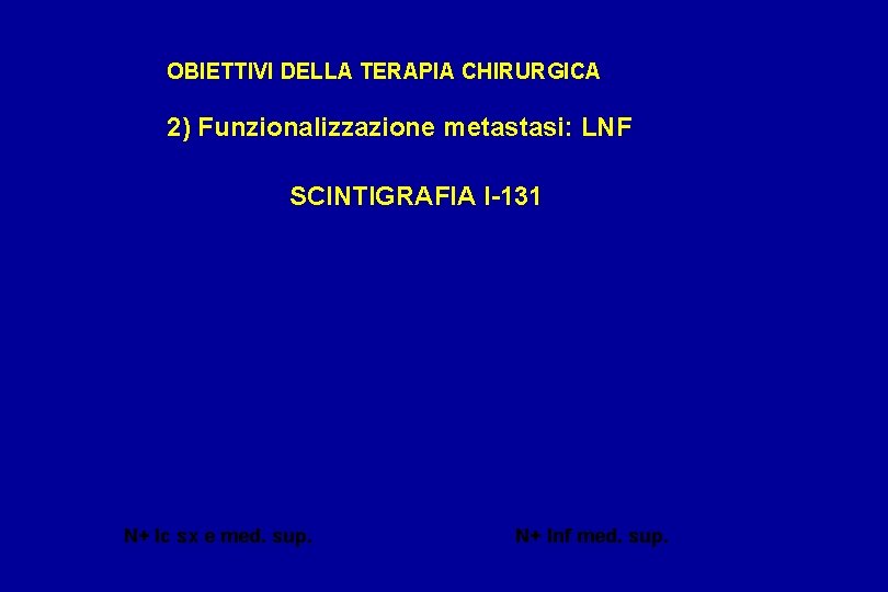 OBIETTIVI DELLA TERAPIA CHIRURGICA 2) Funzionalizzazione metastasi: LNF SCINTIGRAFIA I-131 N+ lc sx e