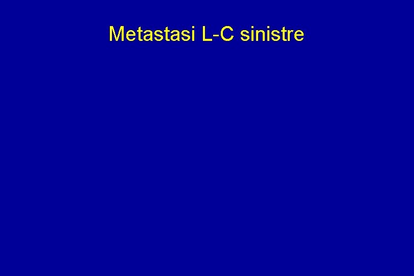 Metastasi L-C sinistre 