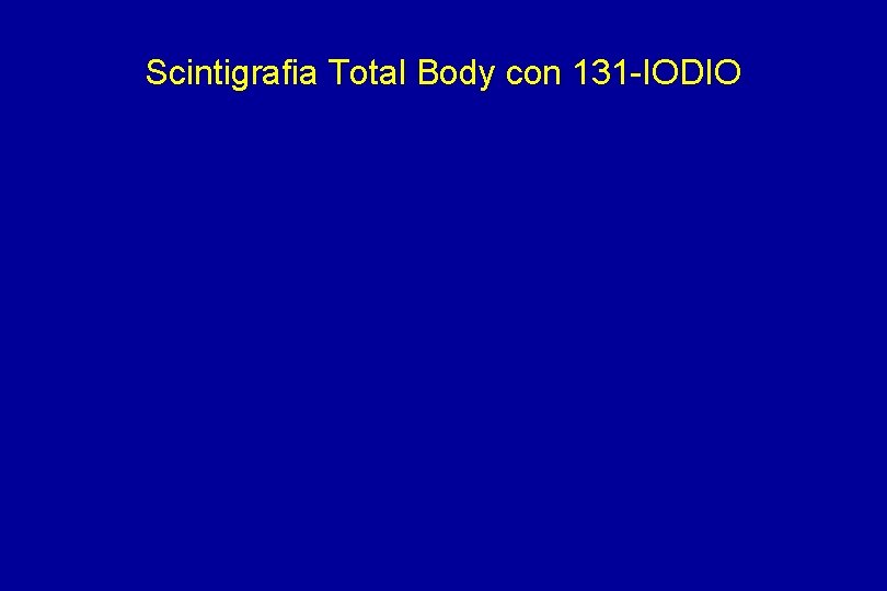 Scintigrafia Total Body con 131 -IODIO 