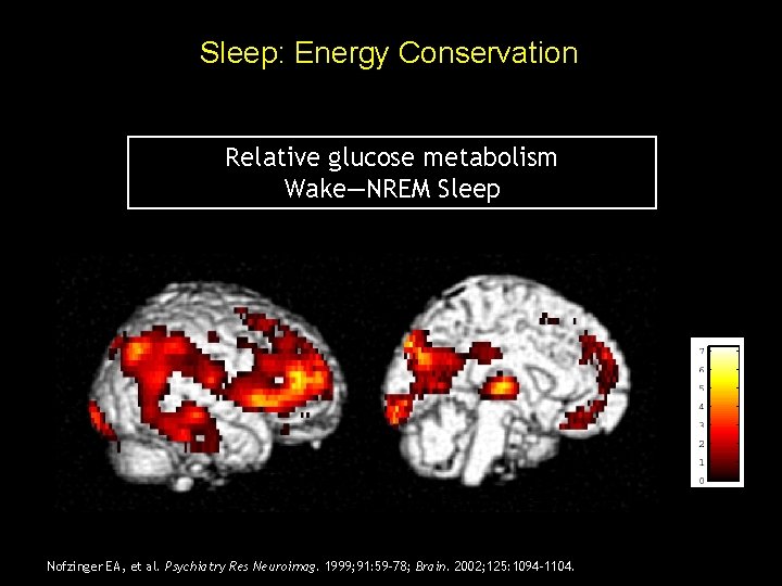 Sleep: Energy Conservation Relative glucose metabolism Wake—NREM Sleep T value Nofzinger EA, et al. Sleep: Energy Conservation Relative glucose metabolism Wake—NREM Sleep T value Nofzinger EA, et al.