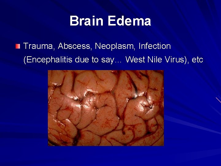 Brain Edema Trauma, Abscess, Neoplasm, Infection (Encephalitis due to say… West Nile Virus), etc Brain Edema Trauma, Abscess, Neoplasm, Infection (Encephalitis due to say… West Nile Virus), etc