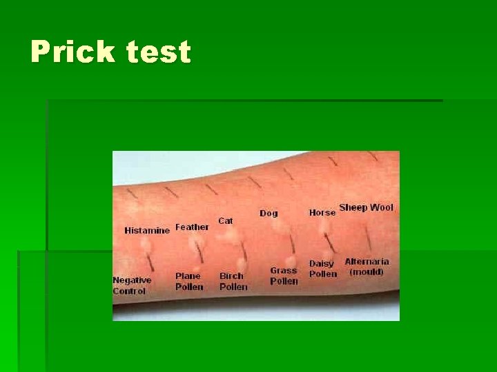 Prick test 