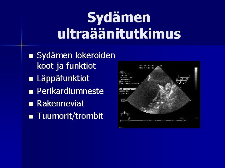 Sydämen ultraäänitutkimus n n n Sydämen lokeroiden koot ja funktiot Läppäfunktiot Perikardiumneste Rakenneviat Tuumorit/trombit