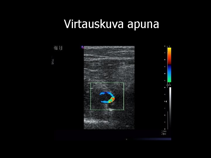 Virtauskuva apuna 