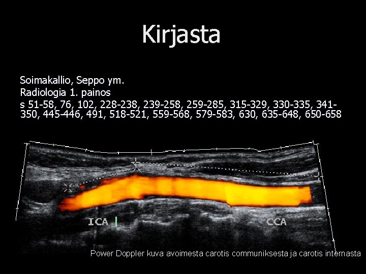 Kirjasta Soimakallio, Seppo ym. Radiologia 1. painos s 51 -58, 76, 102, 228 -238,