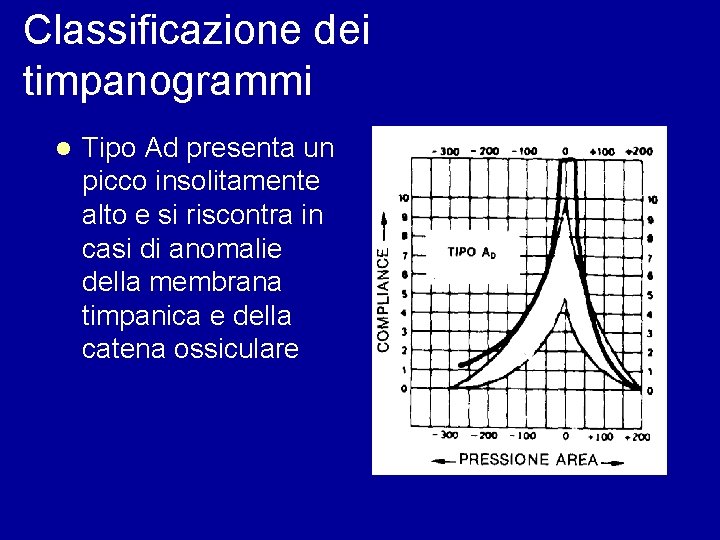 Classificazione dei timpanogrammi l Tipo Ad presenta un picco insolitamente alto e si riscontra