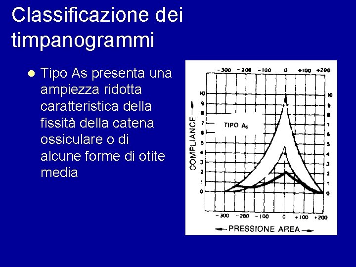 Classificazione dei timpanogrammi l Tipo As presenta una ampiezza ridotta caratteristica della fissità della