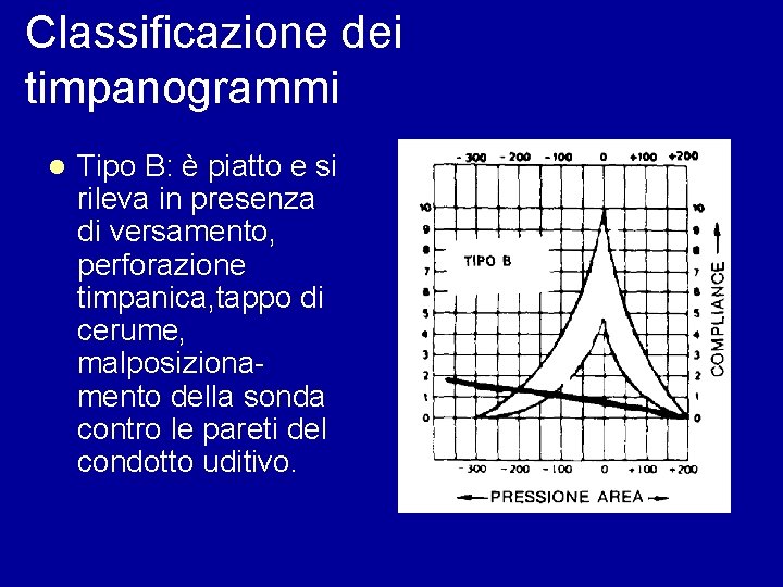 Classificazione dei timpanogrammi l Tipo B: è piatto e si rileva in presenza di