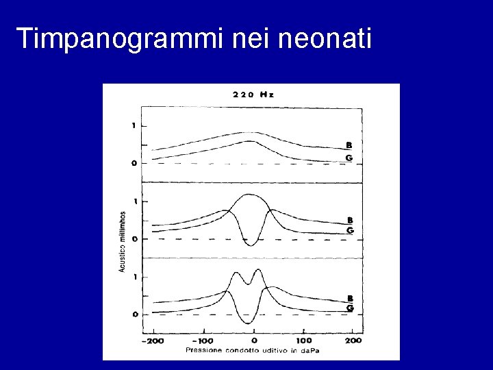 Timpanogrammi neonati 