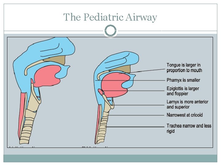 The Pediatric Airway 