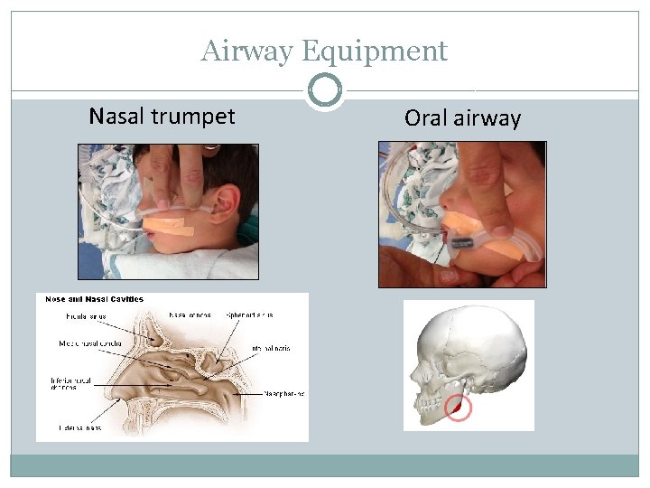 Airway Equipment Nasal trumpet Oral airway 