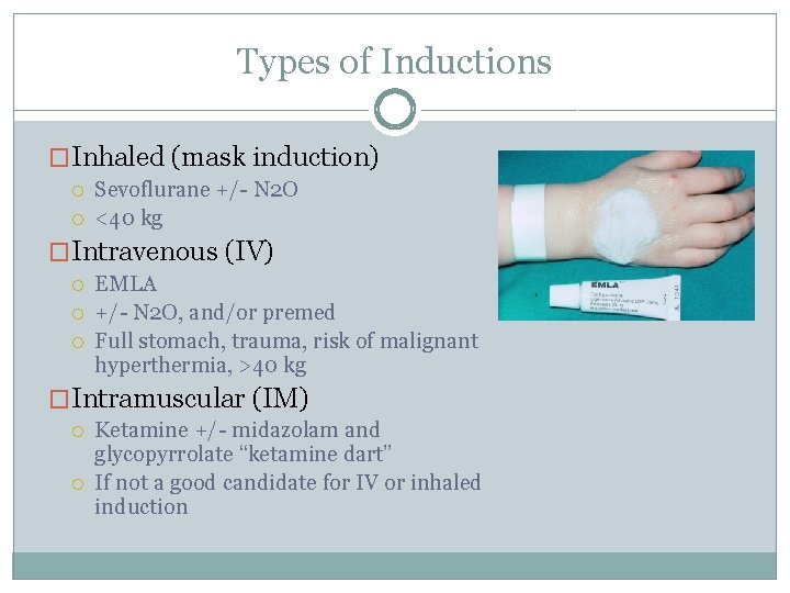 Types of Inductions �Inhaled (mask induction) Sevoflurane +/- N 2 O <40 kg �Intravenous