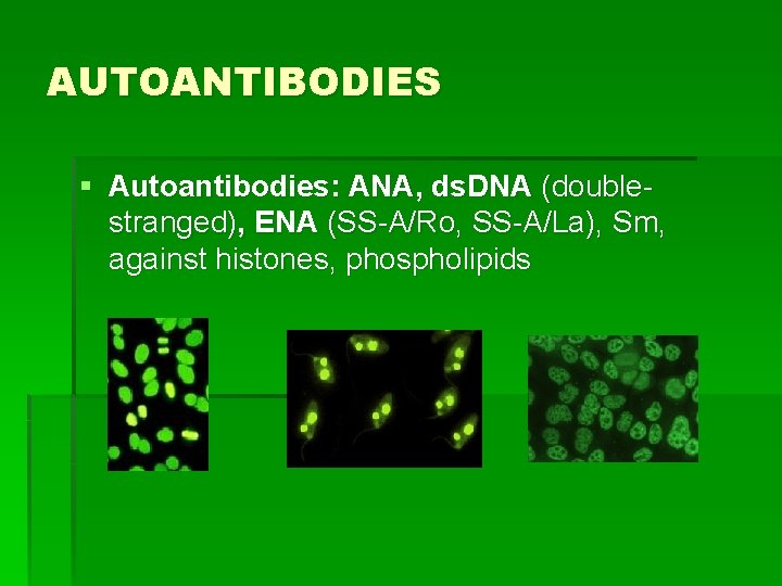 AUTOANTIBODIES § Autoantibodies: ANA, ds. DNA (doublestranged), ENA (SS-A/Ro, SS-A/La), Sm, against histones, phospholipids