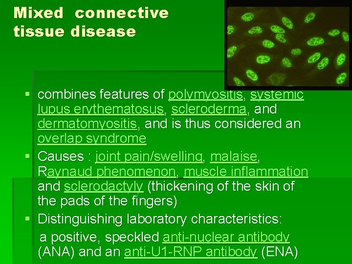 Mixed connective tissue disease § combines features of polymyositis, systemic lupus erythematosus, scleroderma, and