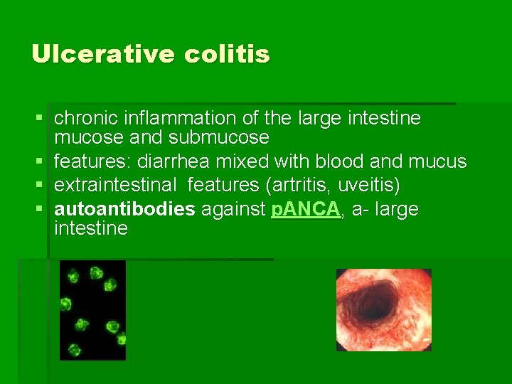 Ulcerative colitis § chronic inflammation of the large intestine mucose and submucose § features: