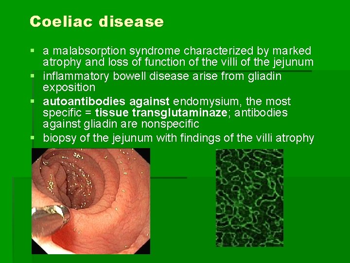 Coeliac disease § a malabsorption syndrome characterized by marked atrophy and loss of function