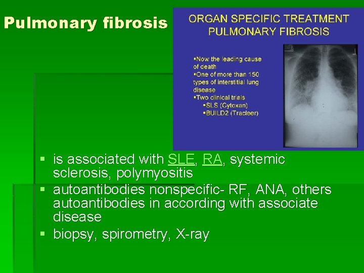 Pulmonary fibrosis § is associated with SLE, RA, systemic sclerosis, polymyositis § autoantibodies nonspecific-