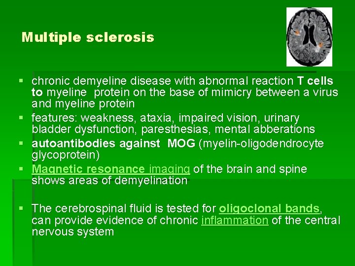 Multiple sclerosis § chronic demyeline disease with abnormal reaction T cells to myeline protein