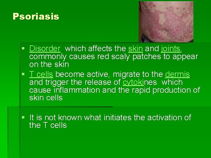 Psoriasis § Disorder which affects the skin and joints, commonly causes red scaly patches