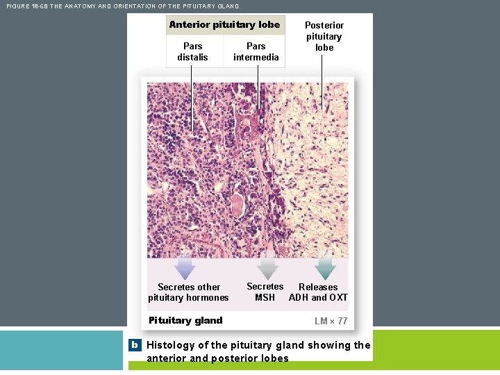 FIGURE 18 -6 B THE ANATOMY AND ORIENTATION OF THE PITUITARY GLAND. Anterior pituitary