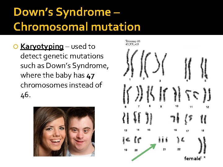 Down’s Syndrome – Chromosomal mutation Karyotyping – used to detect genetic mutations such as