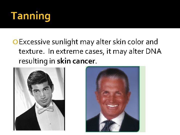 Tanning Excessive sunlight may alter skin color and texture. In extreme cases, it may