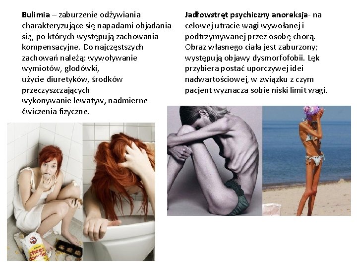 Bulimia – zaburzenie odżywiania charakteryzujące się napadami objadania się, po których występują zachowania kompensacyjne.