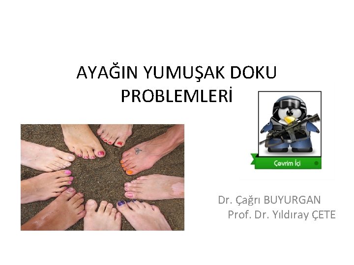 AYAĞIN YUMUŞAK DOKU PROBLEMLERİ Dr. Çağrı BUYURGAN Prof. Dr. Yıldıray ÇETE 