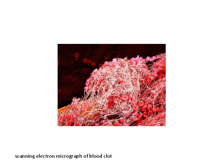 scanning electron micrograph of blood clot 