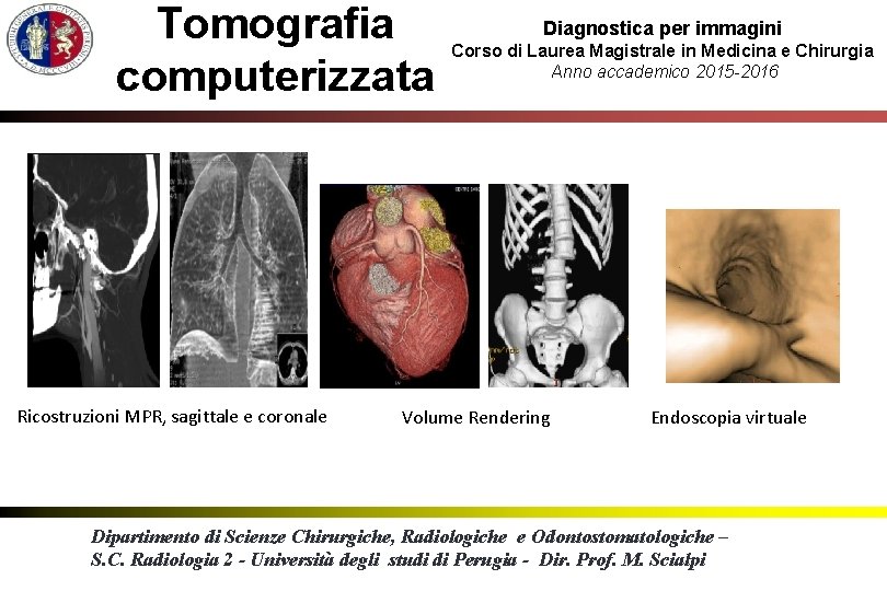 Tomografia computerizzata Ricostruzioni MPR, sagittale e coronale Diagnostica per immagini Corso di Laurea Magistrale