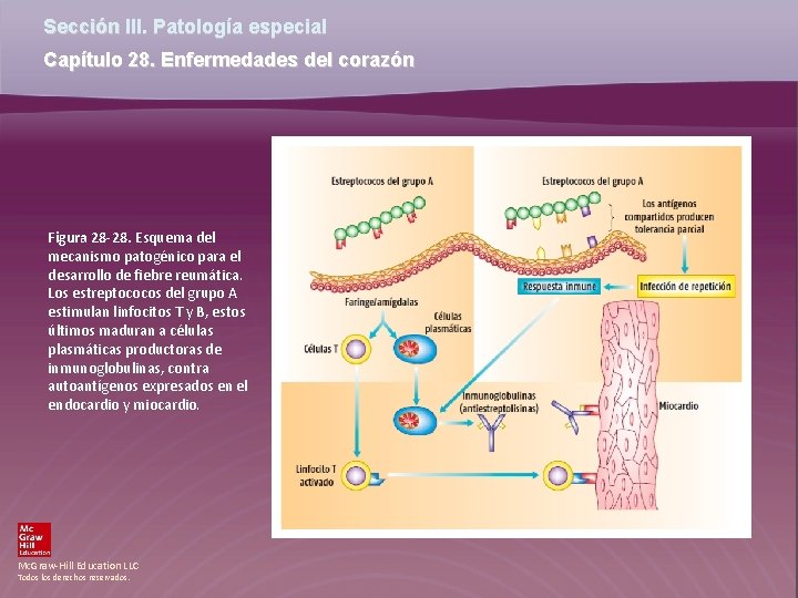 Sección III. Patología especial Capítulo 28. Enfermedades del corazón Figura 28 -28. Esquema del